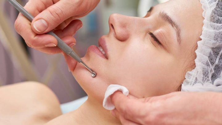facial with extractions in Portland, OR