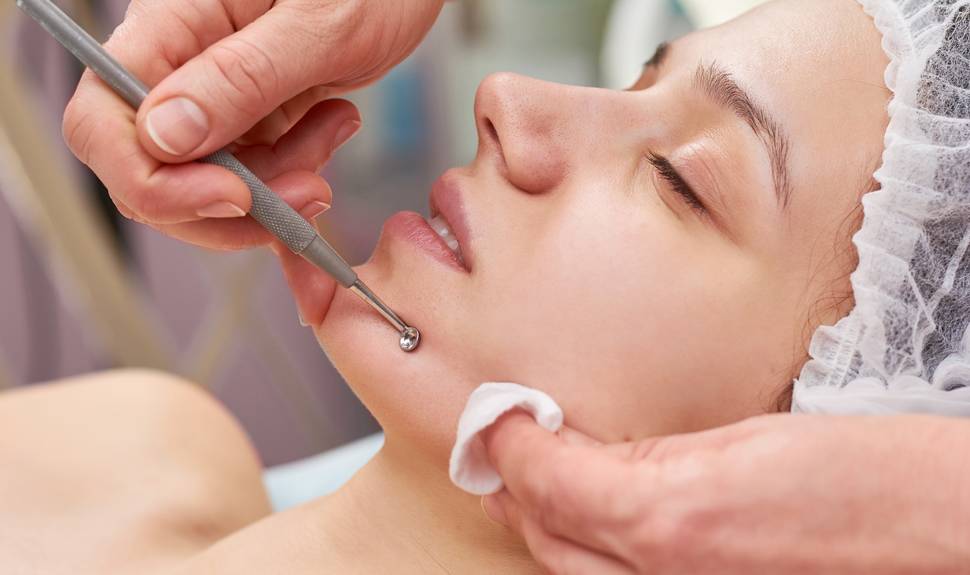facial with extractions in Portland, OR
